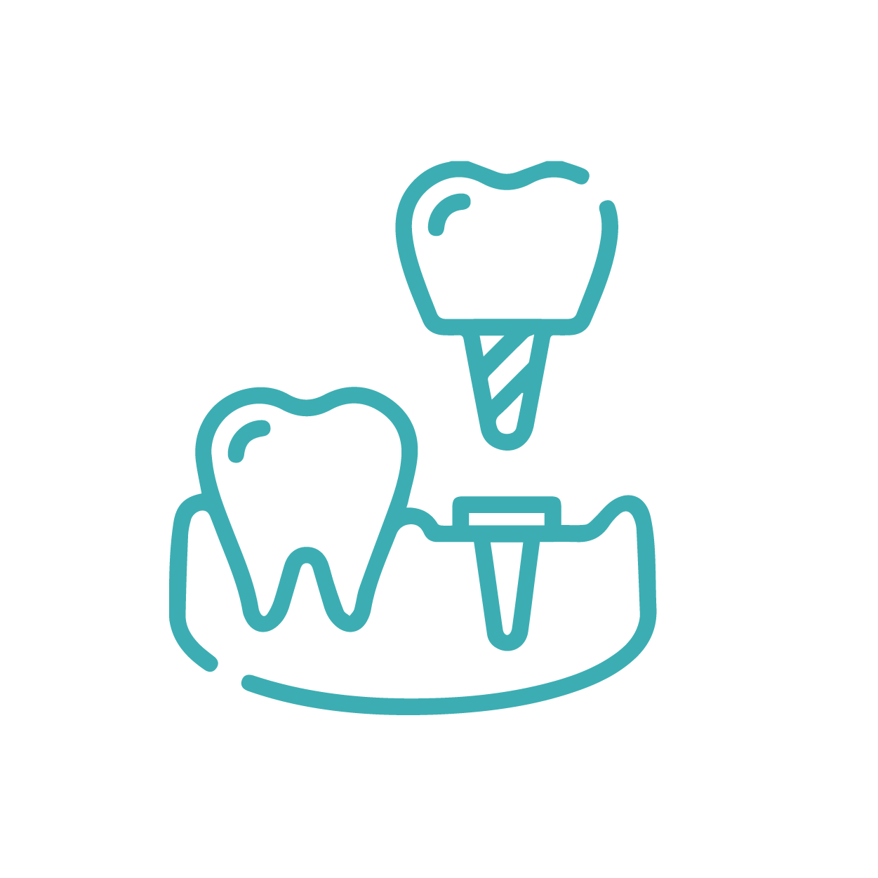 Dental Implants Icon
