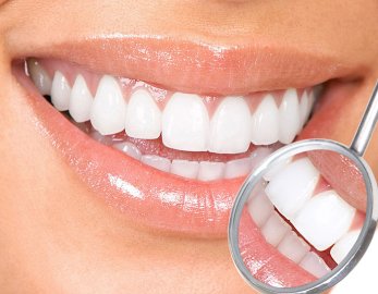 In-office professional laser teeth whitening procedure at TopDent