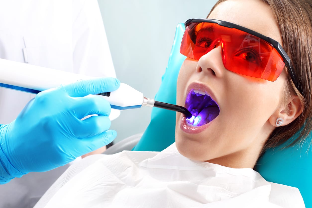Specialist performing high-precision laser dentistry treatment at TopDent Dubai